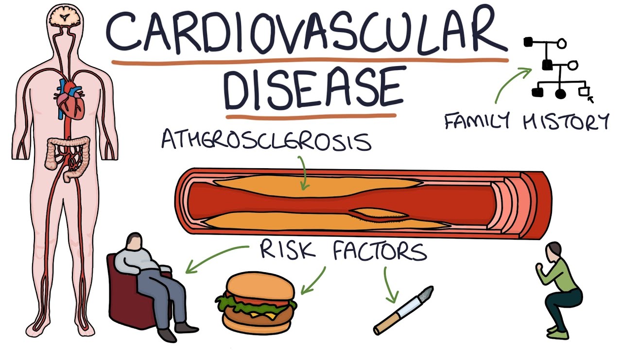 Comprehensive Cardiovascular Disease (CVD) Treatment