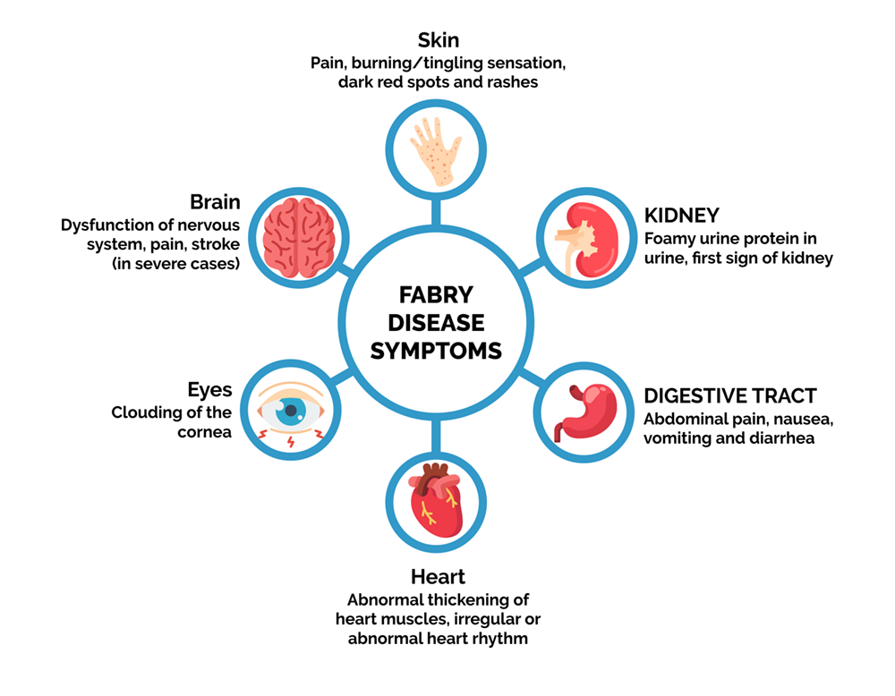 Fabry disease - Treatians