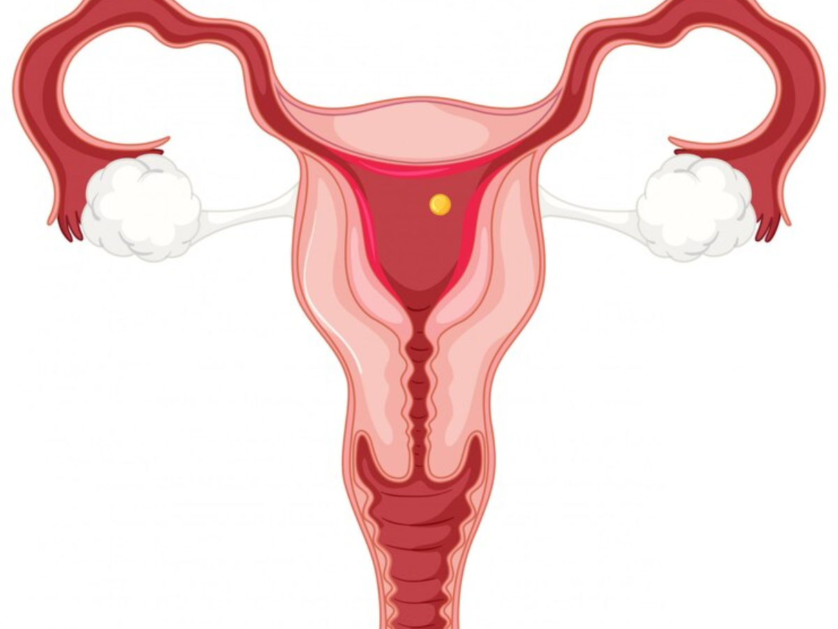 Have You Heard Of Uterine Fibroid Embolization? Read Here!