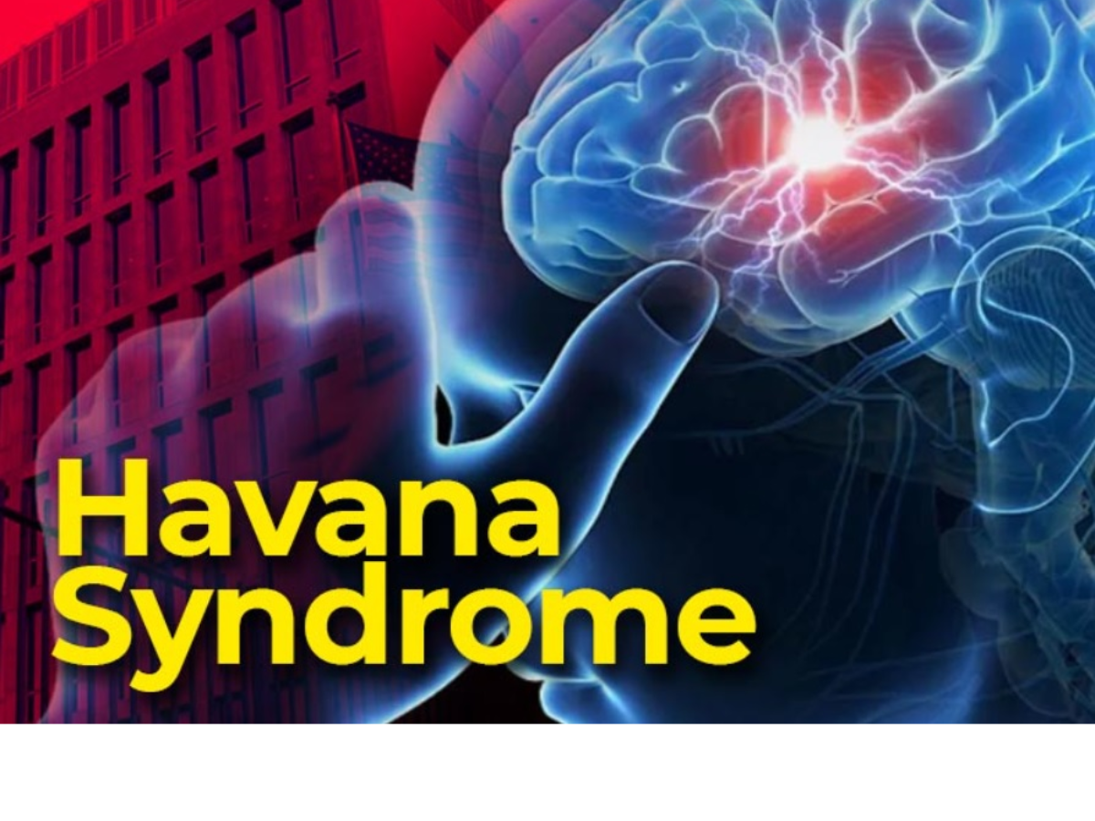What is Havana Syndrome? Know Causes and Symptoms