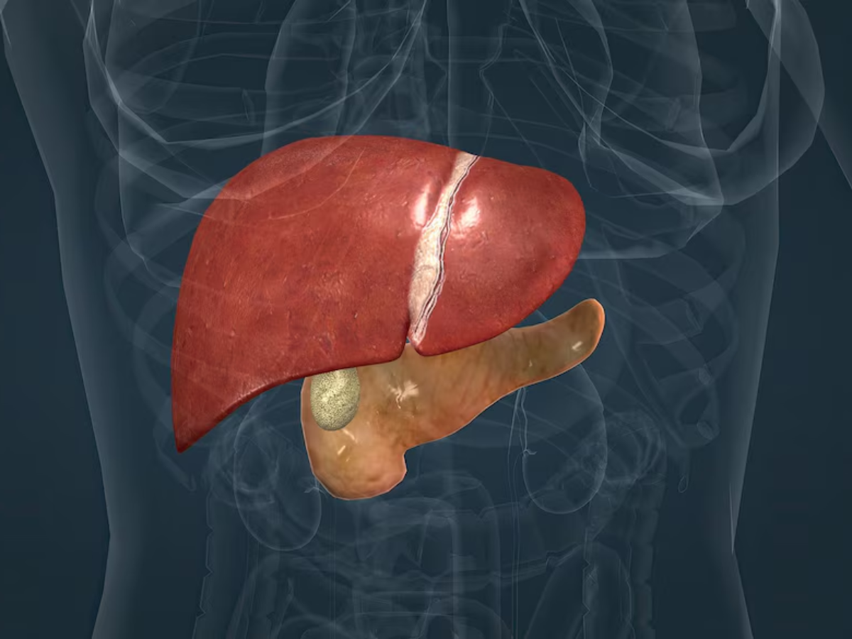 What is Cholestatic Liver Disease? Read Here!