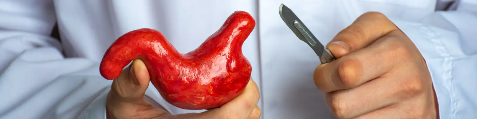 Bariatric Surgery
