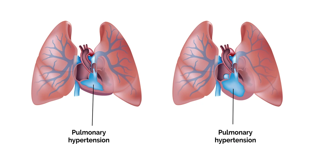 Pulmonology lung health check-up