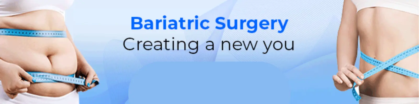 Bariatric Surgery