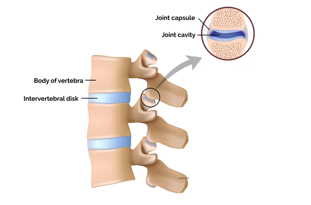 facet nerve block injection for back pain