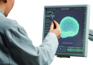 Oncology service by Treatians for cancer diagnosis and treatment